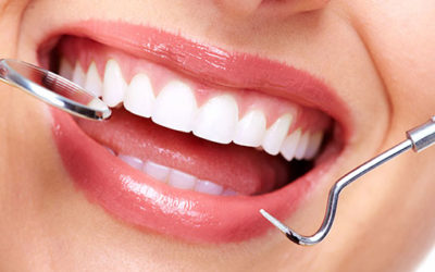 Deep Teeth Cleaning for Good Health